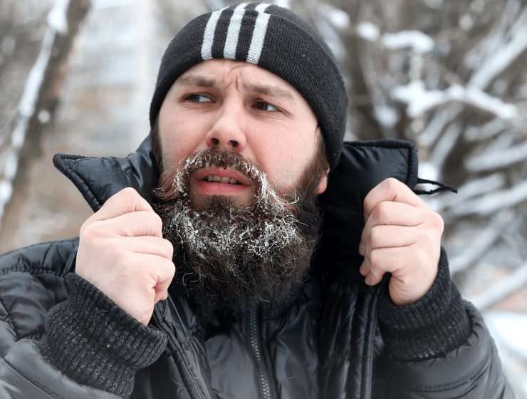 védd hajadat télen sapkával