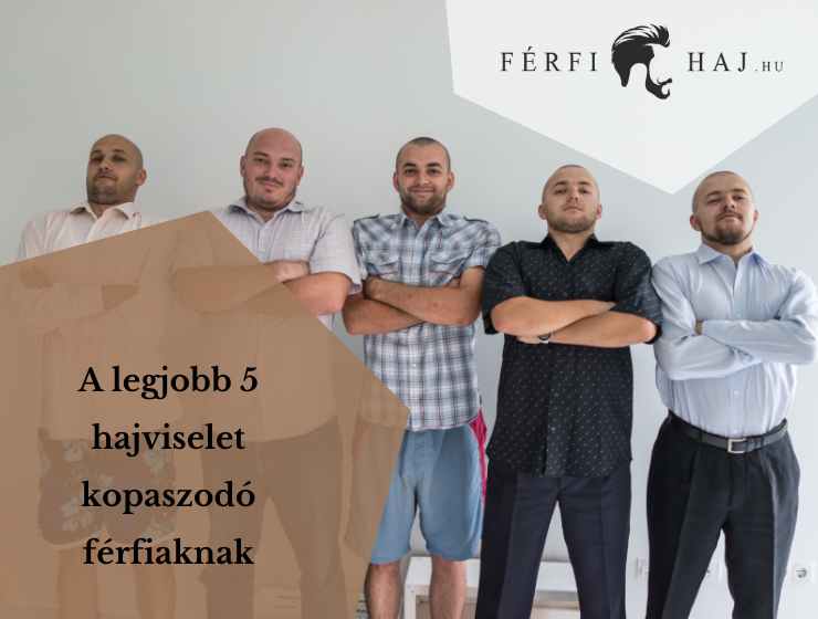 férfi frizurák kopaszodóknak